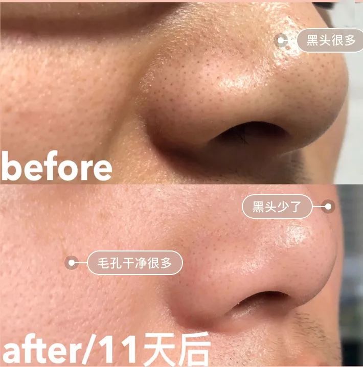 一块驴奶皂搞定洁面、卸妆,还能洗澡去鸡皮!我要回购10000次