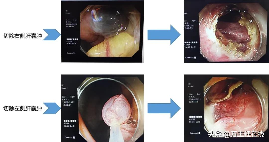 镜益求精！上海市第一人民医院万荣团队为患者带来“无痕”的美丽