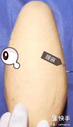 香蕉割包皮,洋葱剖腹产?这是我见过最秀的医生