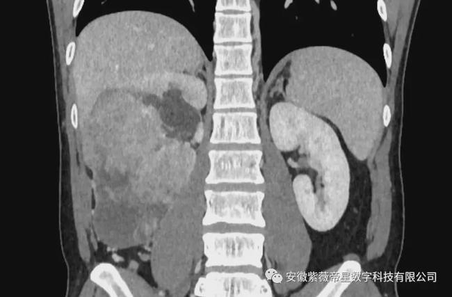 紫薇帝星穴,紫薇帝星医疗科技