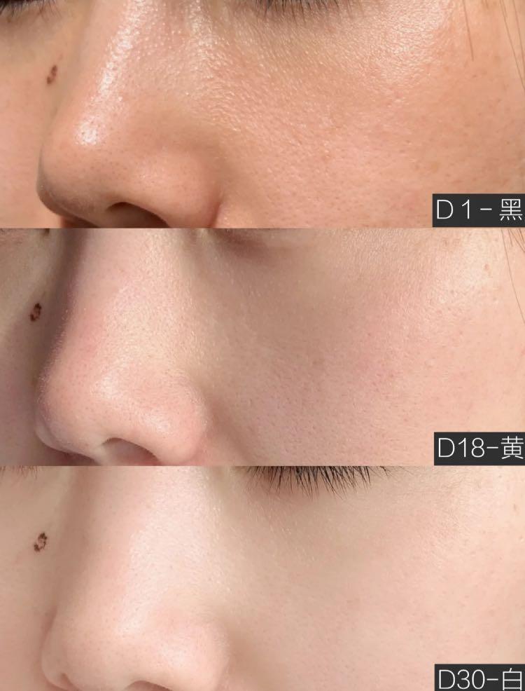 女人为什么不能打美白针,千万别打美白针真的会要人命