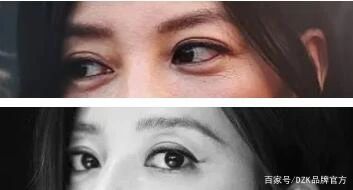 多层眼皮是如何修复的,多层眼皮该怎么消除