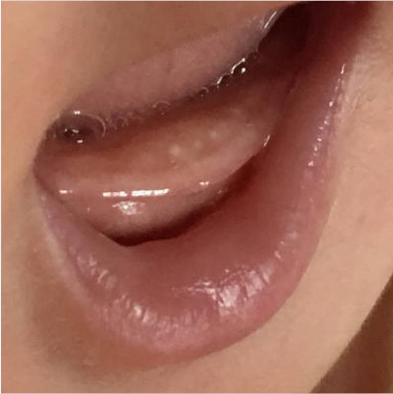 婴儿出牙顺序不正确是什么原因,你家宝宝长牙顺序图