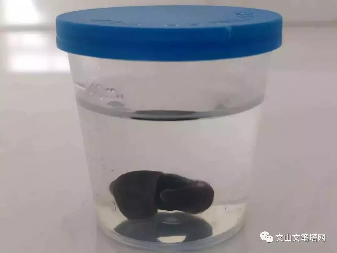 吓人!广南一男子气管内发现6厘米蚂蟥,文山人注意了……