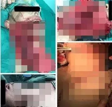 戒了零食会是什么样,戒了吧零食