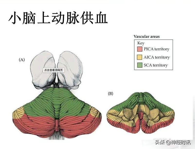 脑动脉解剖学讲解,基底节区脑血管解剖