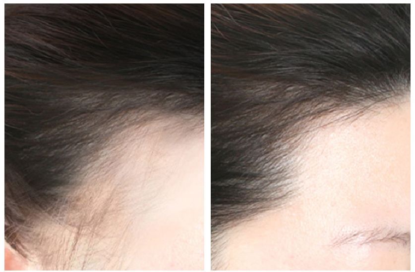 防脱大作战,防脱发不踩雷