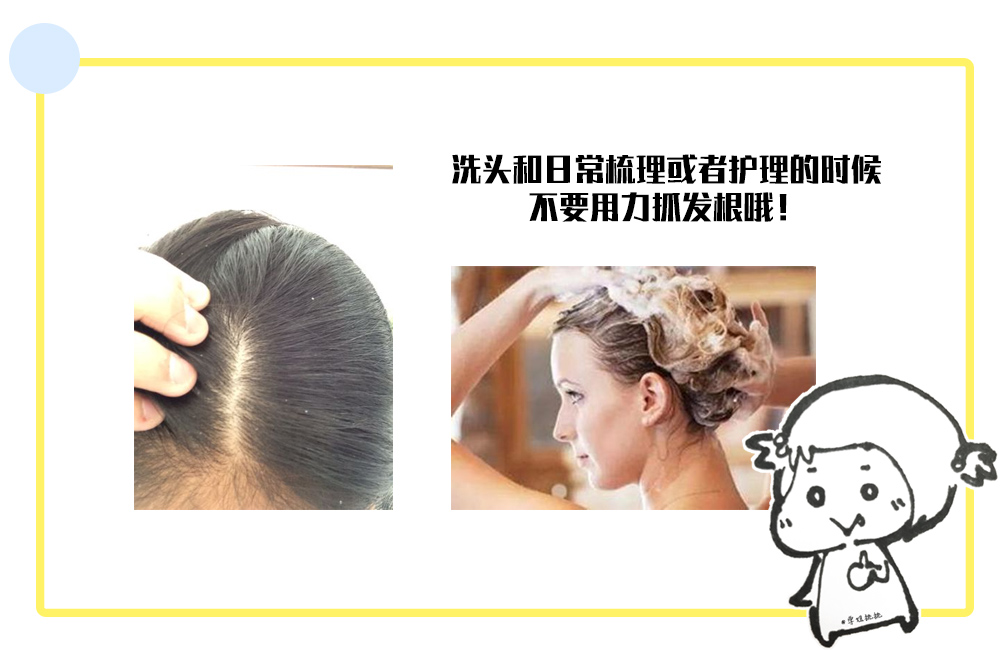 扎头发发际线高怎样修刘海,扎头发简单好看保护发际线