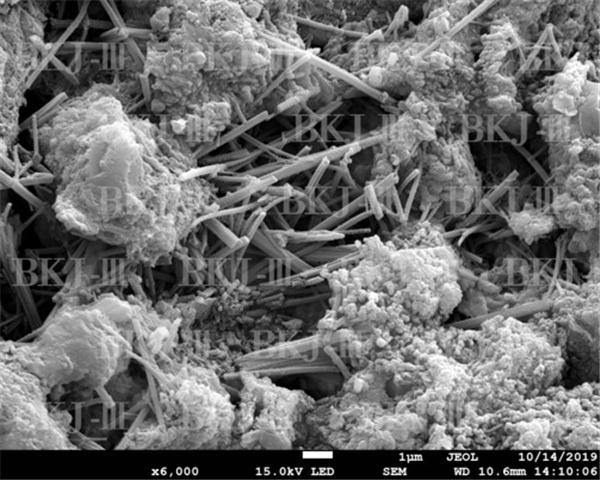 结晶和结石的区别是什么,结晶vsd