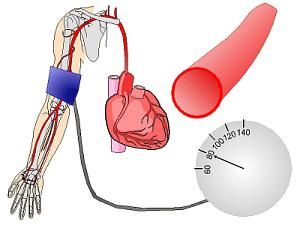 高血压可怕的真实案例,高血压的常见表现症状有哪些呢