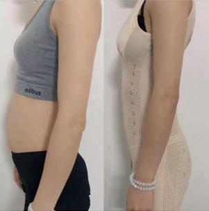 明星怀孕二胞胎40周的过程,为什么明星怀孕恢复快