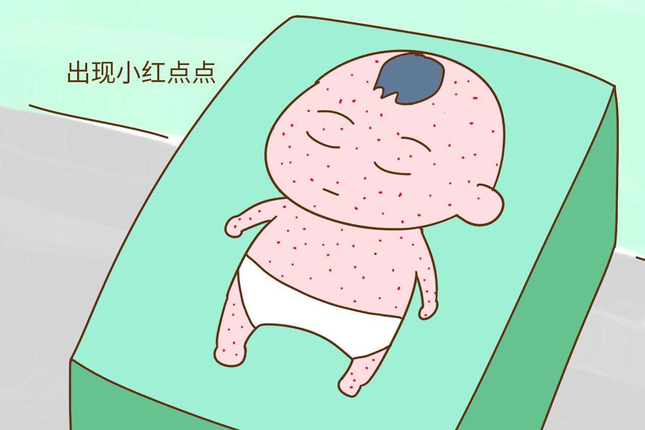 孩子高烧起急疹,小孩高烧后出现急疹需要输液吗