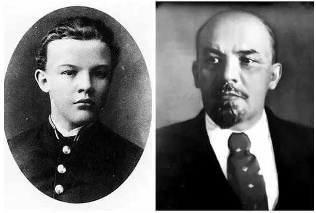 脱发真的很影响颜值么,脱发除了遗传还有什么原因