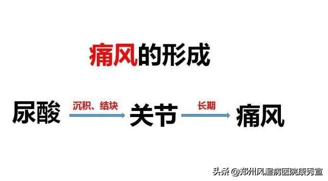 痛风发作怎么可以快速缓解,痛风突然发作怎么样可以马上止痛