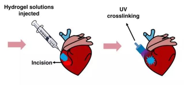 纳米技术让伤口快速愈合的凝胶,神奇胶水60秒缝合伤口