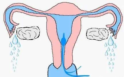 输卵管检查通液和造影哪个好,输卵管做通液好还是造影好