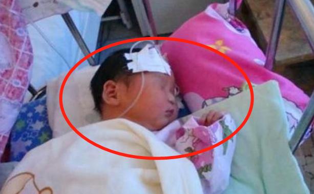 妈妈发现孩子有点黄怎么办,宝宝身上长了个大大的黑头