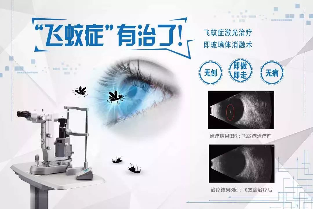 飞蚊症有蚊子飞严重吗,飞蚊症眼前只有一只蚊子