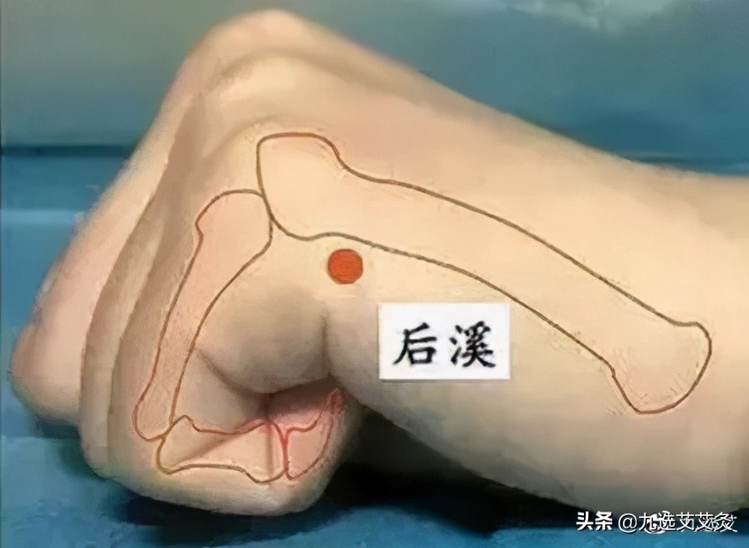 一觉醒来脖子疼肩膀疼用什么药,一觉醒来脖子痛怎么解决