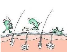 小孩脚部白癜风,小孩湿疹后擦药导致白癜风