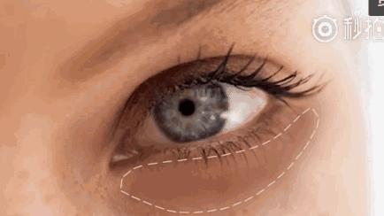 久治不消的黑眼圈,一支口红就能搞定