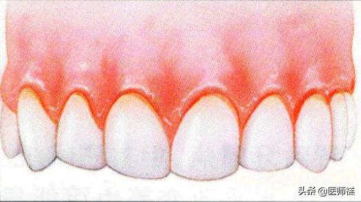 脸上长痘痘缺乏什么维生素,缺少维生素脸上的表现