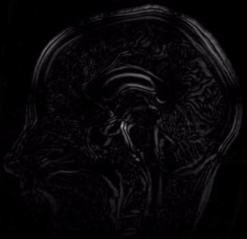 图像识别算法方程,图像锐化算子的常用算法