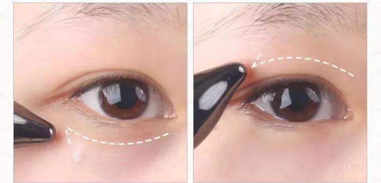 关晓彤有没有黑眼圈,关晓彤黑眼圈困扰