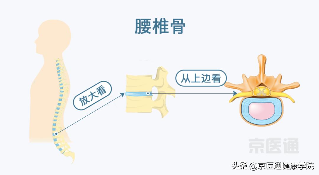 腰痛骨科怎么治疗,腰痛腿痛有什么特效药