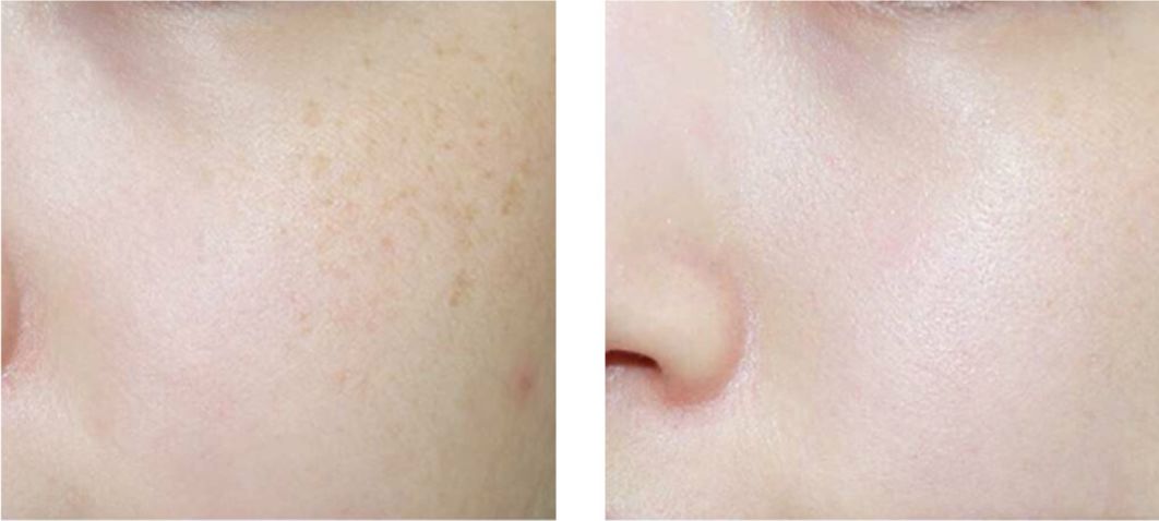 国货美白淡斑精华液,国货美白补水淡斑