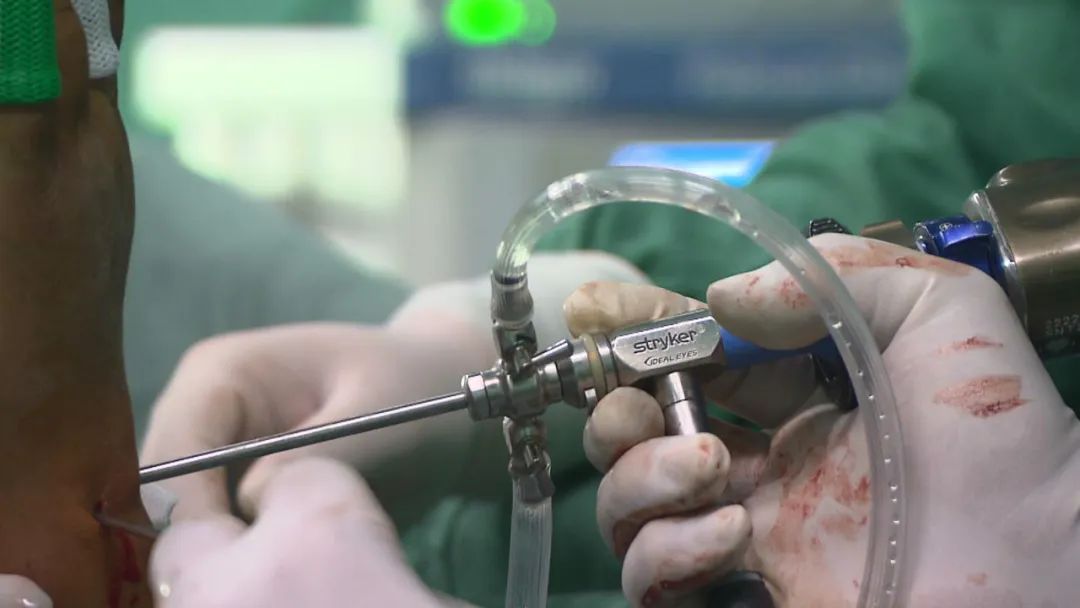 手外足显微外科护理亮点,鲅鱼圈区医院手足外科