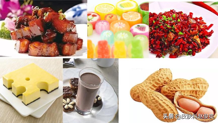 疮疡病病人的症状,疮是怎么引起的怎么治