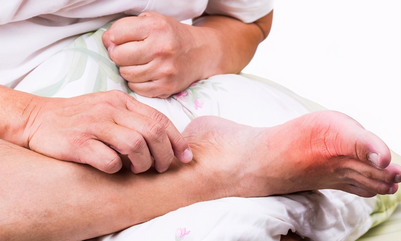 痛风发作有什么办法可以快速止痛,痛风吃布洛芬可以快速止痛吗