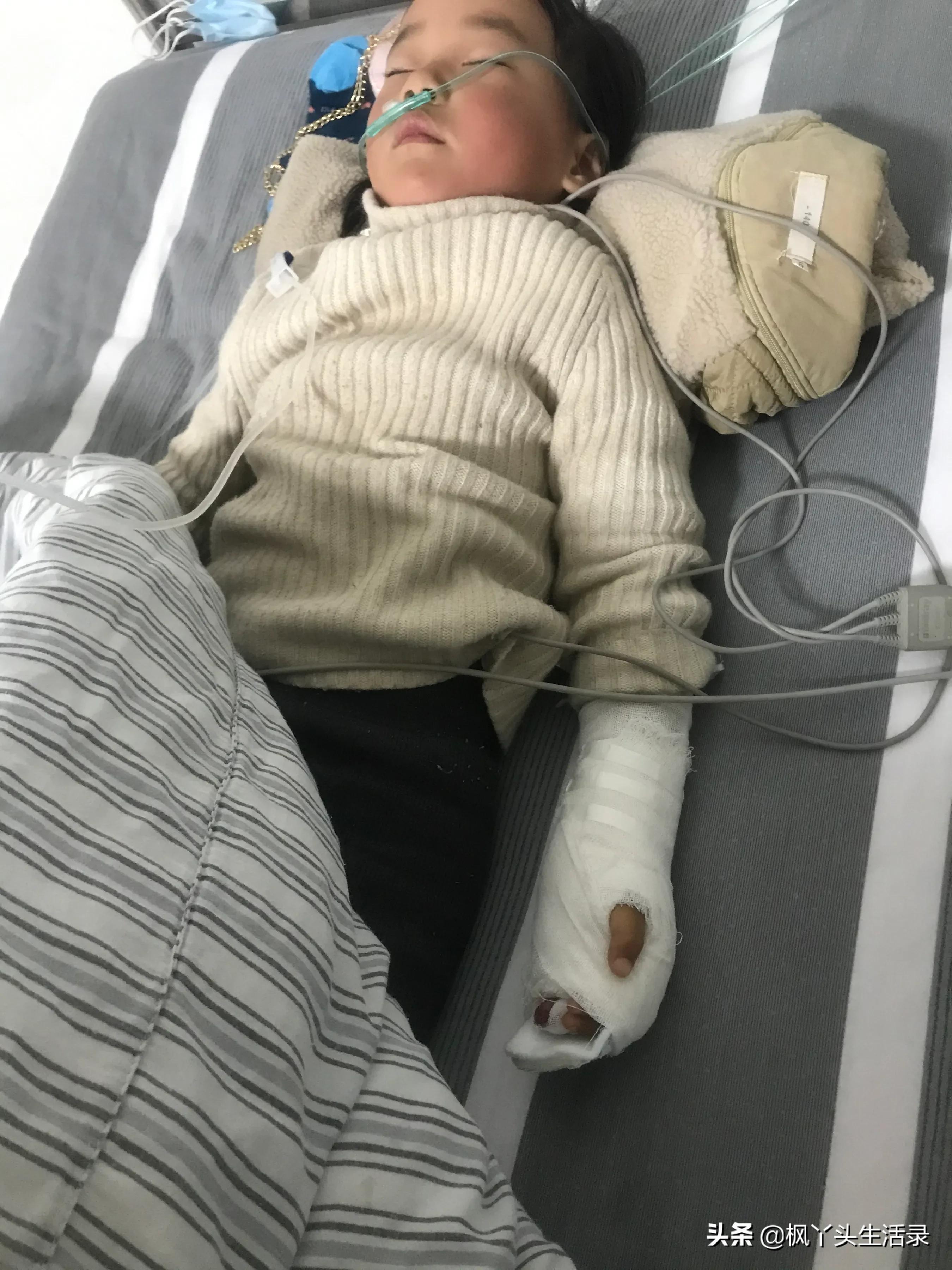 女儿手指被夹断了,梦到女儿手指头被夹断了