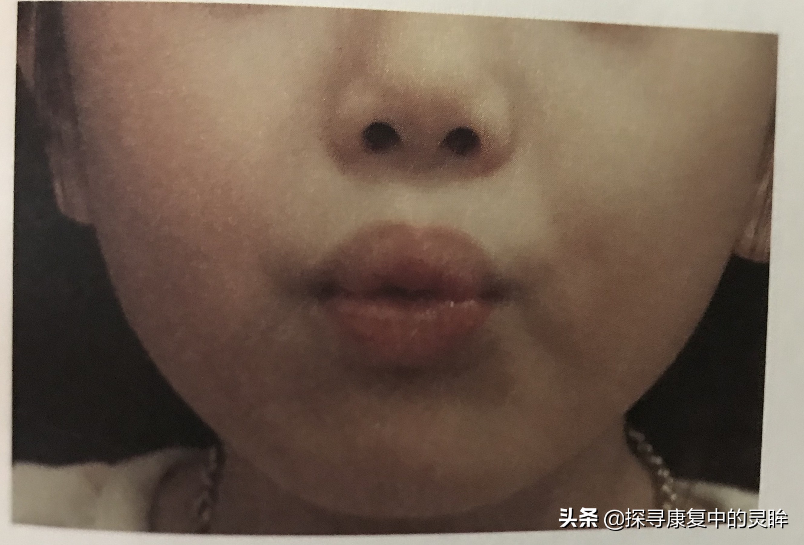 五种口部运动:灵活孩子的樱桃小嘴,让他们说话更清晰(超简单)