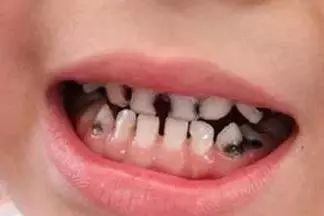 宝宝刷牙应该怎么选牙刷和牙膏,宝宝多大开始需要用牙膏刷牙