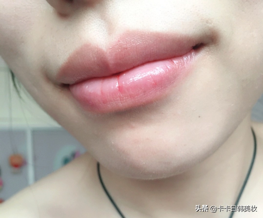 唇纹深嘴唇干裂起皮小妙招,嘴唇干燥脱皮唇纹深用什么唇膏好