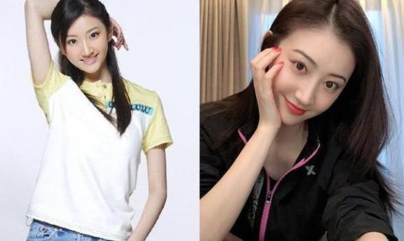 景甜自曝埋线失败完整版,景甜自曝割双眼皮经历