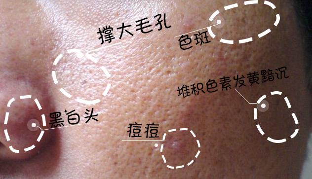 皮肤怎么变得白白嫩嫩干干净净,怎么让自己变得白白嫩嫩