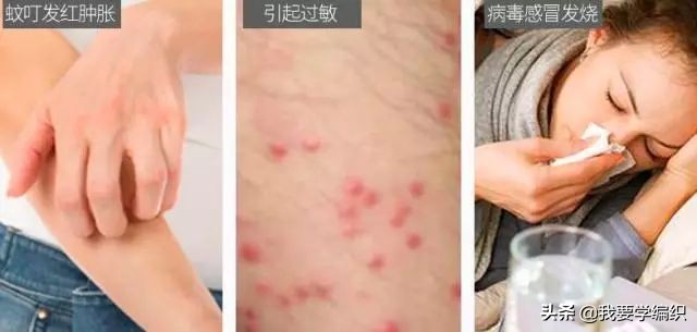 全网狂销10W+盒,日本“变态”驱蚊剂!网友:1盒搞定整个夏天