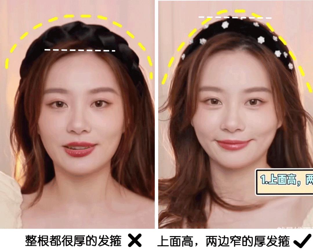 颅顶高了但发际线高怎么办,颅顶低的几种补救办法