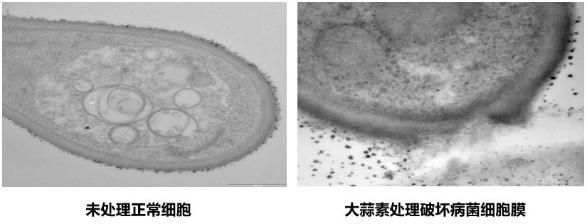 大蒜素能预防真菌感染吗,大蒜素治疗细菌感染