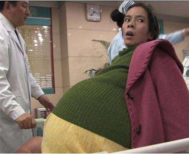 彭细妹为求子尝试偏方：肚子一天天变大，12个月了还没生产