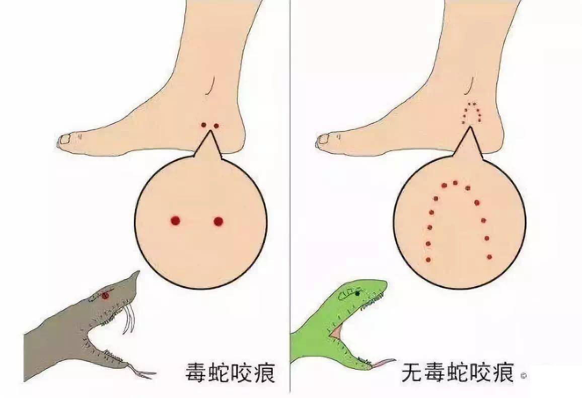 被蟒蛇缠住装死有用吗,被巨蟒缠住能活多久