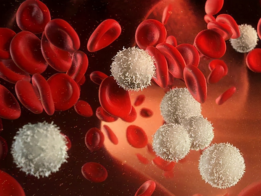 急性白血病临床表现与实验室检查,急性早幼粒细胞白血病怎么检查