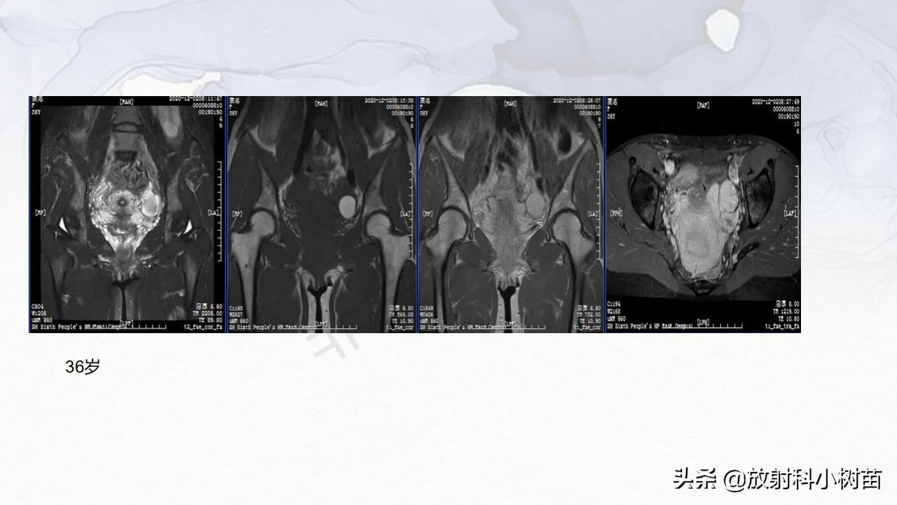女性盆腔mri解剖图谱,泌尿生殖系统x线解剖