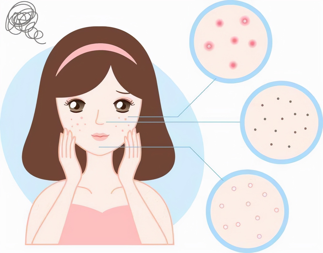 脸上过敏发红发痒怎么办最有效,脸上反复过敏发红发痒是什么原因