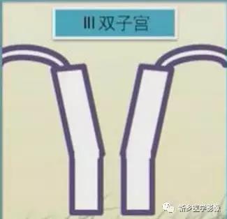 子宫发育异常,应想到的6大类常见畸形