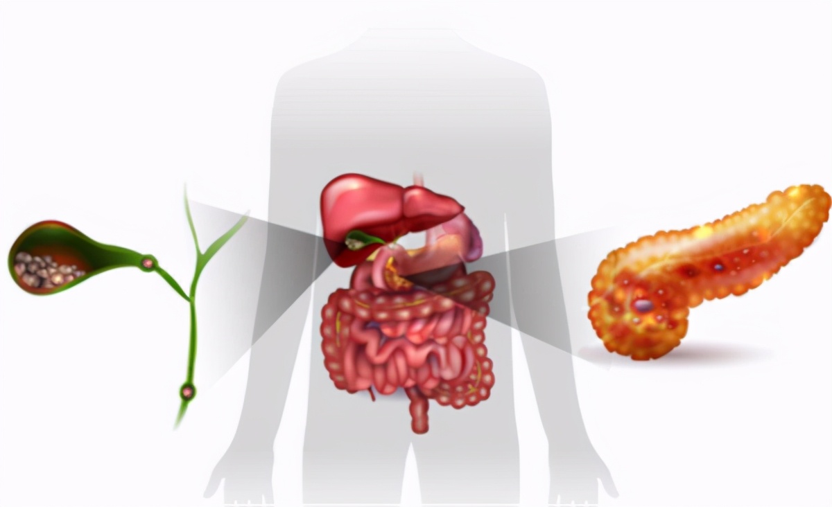胆囊炎吃鸡蛋会是什么症状,胆囊炎胆结石能吃鸡蛋吗