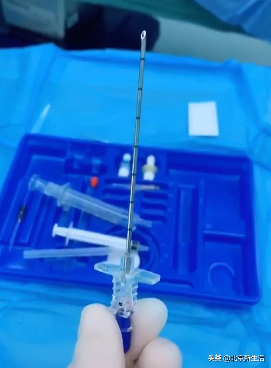 剖宫产简直痛到怀疑人生,剖宫产三次全过程